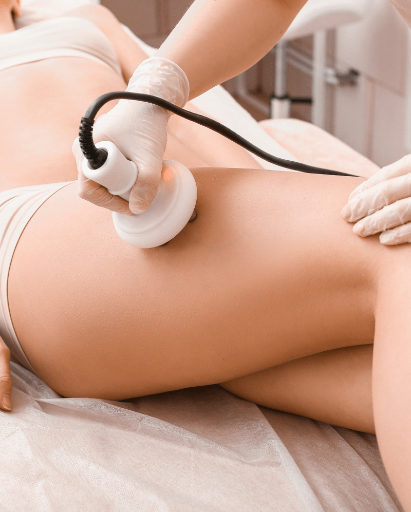 celulitis